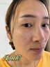片仔癀美白祛斑膏祛斑霜淡化黑色素去雀斑老年黃褐斑祛斑面霜國貨護膚女 美白祛斑膏1瓶【送防曬霜】 50g 曬單實(shí)拍圖