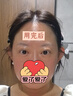 雅萌達人專(zhuān)屬MAX三代鳳仙紫旗艦版美容儀家用面部大排燈嫩膚美白促滲淡斑送禮【送女友生日禮物】 曬單實(shí)拍圖