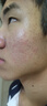 普門(mén)科技醫用大排燈美容儀紅藍黃光治療敏感肌痘痘痤瘡濕疹消炎禮物送女友 光E醫用升級版+送旅行面罩大排燈+語(yǔ)音聲控 曬單實(shí)拍圖