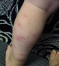 冭川制藥蚊蟲(chóng)叮咬止癢消腫嬰兒寶寶兒童成人清涼便攜舒緩滾珠全家適用 曬單實(shí)拍圖