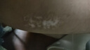 邦臣（BANGCHEN）308白癜風(fēng)治療儀光療儀醫院紫外線(xiàn)燈同款家用銀屑病窄譜nbuvb激光 【強度35/面積3】升級款UV308A2 曬單實(shí)拍圖