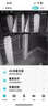 霸天安4G太陽(yáng)能攝像頭 監控室外免插電無(wú)需連wifi終身免流量 監控器360度無(wú)死角帶夜視 全景追蹤手機遠程 曬單實(shí)拍圖