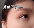 dyey祛痣點(diǎn)痣膏無(wú)痕臉部黑痣扁I平疣痦子瘊子祛斑點(diǎn)斑非薬水面部專(zhuān)用 曬單實(shí)拍圖