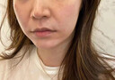 BEAI膠原蛋白灌注面膜炮童顏?lái)f抗皺緊致抗衰老補水美白淡斑雪10片 曬單實(shí)拍圖