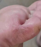 爛腳丫的特強(qiáng)效藥脫皮糜爛腳趾縫爛癢嚴(yán)重腳氣藥止癢脫皮爛腳丫真菌感染止癢根特治效皮膚用藥硝酸咪康唑乳膏 2盒【腳氣腳趾縫潰爛癢水泡】對癥一抹 當(dāng)晚看效 曬單實(shí)拍圖