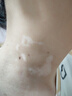 Dr.HillGod德國白癜風(fēng)專(zhuān)用特白斑凈汗斑花癬除裉根真菌感染藥膏藥非進(jìn)口神器 1盒體驗裝【發(fā)貨特效快】白癜風(fēng)專(zhuān)用 曬單實(shí)拍圖