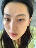 白云山壬二酸祛痘面膜10片淡化痘印控油祛痘毛孔收縮補水保濕男女士 曬單實(shí)拍圖