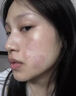 DR.SOKK濕疹藥膏皮膚瘙癢皮炎皮癬真菌感染止癢膏頑固去根陰囊潮濕肛門 曬單實拍圖