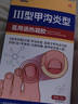 Newliann醫用甲溝炎消腫專(zhuān)用工具息肉紅腫去肉芽嵌甲發(fā)炎化膿膏矯正器制藥 曬單實(shí)拍圖