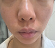 極萌【明星推薦】水光儀抗衰補水祛黃提亮淡紋膠原炮美容儀水光針原液自打儀器全能彈價保雙11 曬單實拍圖