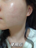 Newliann醫用重組三型人源化膠原蛋白外用人表皮生長(cháng)因子凝膠皮膚疤痕修復 曬單實(shí)拍圖