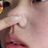 無(wú)語(yǔ)控油水茶里茶氣爽膚水乳面部護膚套裝舒緩去閉口痘肌水油精華 茶里茶氣爽膚水120ml 曬單實(shí)拍圖