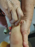 廾卜制藥蚊蟲(chóng)叮咬止癢消腫嬰幼兒童滾珠型戶(hù)外止癢抑菌皮膚瘙癢身體癢神器 曬單實(shí)拍圖