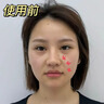 SEOMOU嘴角皺紋法令紋貼八字紋細紋改善去除精華法令紋消除提拉緊致面膜 單盒裝【5對/盒】法令紋貼 曬單實(shí)拍圖