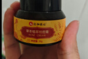 仁和匠心草本祛痘膏去痘印學(xué)生去青春痘痤瘡閉口粉刺修護痘肌淡化痘坑痘印 曬單實(shí)拍圖