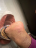 BEAI皸裂腳裂膏腳后跟防干裂皸裂龜裂開(kāi)裂凍裂膏護手足干裂潤膚霜 60g 曬單實(shí)拍圖