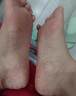 云南本草腳氣白藥真菌感染止癢殺抑菌特效腳氣腳癢藥膏店水泡爛脫皮噴霧劑 買(mǎi)2發(fā)3【一噴見(jiàn)效】腳丫足部專(zhuān)用 去的噴根治后跟開(kāi)裂療臭真菌王手癬 曬單實(shí)拍圖