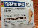 BEAI皸裂腳裂膏腳后跟防干裂皸裂龜裂開(kāi)裂凍裂膏護手足干裂潤膚霜 60g 曬單實(shí)拍圖