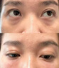 暨笙語(yǔ)重組三型膠原蛋白面部精華填充太陽(yáng)穴凹陷淚溝抬頭川字法令紋提升 普通膠原一組《三組起拍》 曬單實(shí)拍圖
