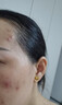 樂(lè )敦（ROHTO）CC美白精華液升級版20ml祛痘修復提亮進(jìn)口男女生日禮物雙十一 曬單實(shí)拍圖