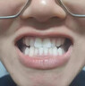 日本生物醫學(xué)研究院（JAPAN INSTITUTE OF BIOMEDICAL RESEARCH）牙齒松晃動(dòng)固齒牙齦出血萎縮防蛀護齦亮白去黃去漬再生硅牙膏H 【體驗裝】實(shí)發(fā)一大盒 曬單實(shí)拍圖