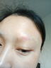 邦臣（BANGCHEN）308白癜風(fēng)治療儀光療儀醫院紫外線(xiàn)燈同款家用銀屑病窄譜nbuvb激光 【強度20/面積3 】基礎款UV308A1 曬單實(shí)拍圖