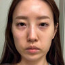 BAILUHUI水光彈潤補水面膜保濕緊致修護提亮敏感肌男女士面膜5片 曬單實(shí)拍圖
