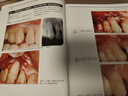 牙周再生術(shù)(直通成功的技術(shù)戰略)(精) 曬單實(shí)拍圖