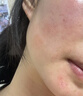 自然攻略依克多因舒敏修護面膜敏感肌舒敏保濕補水舒緩熬夜紅臉 1盒 【買(mǎi)1盒到手7片】嘗鮮裝 曬單實(shí)拍圖