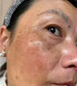 膚研老年斑祛斑霜美白祛斑霜淡化黑色素去雀斑黃褐斑臉部手背祛斑專(zhuān)用 特效：一盒裝【祛斑一夜消】 美白淡化祛斑霜黃褐雀斑曬斑男女士用的中藥特效一夜消 曬單實(shí)拍圖