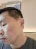 同仁堂祛痘膏去痘印修復淡化痘印痘坑20g中秋 曬單實(shí)拍圖