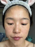 DR.CFUN377美白高保濕面霜男女士淡斑美白祛斑霜淡化黑色素面霜抗皺緊致 【1抹見(jiàn)效】美白保濕淡斑霜60g*1 專(zhuān)利美白保濕 曬單實(shí)拍圖