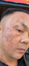 臉上黑色素沉淀去除臉部排毒排黑色素去黑斑點(diǎn)去黑色素臉部醫用皮膚色素暗沉痘印曬斑淡斑美白熊果苷軟膏 買(mǎi)二送一【免費試用】3盒 曬單實(shí)拍圖