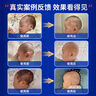 盟石（cute stone）定型枕頭嬰兒0-6個(gè)月睡圓頭嬰兒枕頭0-1歲糾正偏頭型新生兒童枕頭 白藍 【0-2歲】 10A抗菌-安撫固定柱 0-2歲寶寶定型枕頭可機洗 曬單實(shí)拍圖