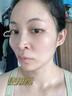 SEEDONVEUR煙酰胺凝膠美白祛斑霜淡化黑色素去斑霜雀斑黃褐斑老年斑曬斑 20g 曬單實(shí)拍圖