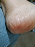 卡貝娜（Kabeina）腳后跟干裂修復霜手足龜裂開(kāi)裂皸裂治起皮去死皮潤馬油皺裂膏 1瓶【滋養修護 保濕滋潤】 曬單實(shí)拍圖