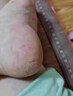 李福記手足皸裂膏腳后跟干裂口足跟粗糙干燥專(zhuān)用防止手足干裂脫皮凍瘡膏 100g 3瓶 手足皸裂干裂 曬單實(shí)拍圖