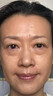 歐誘眼袋霜去大眼袋嚴重中老年專(zhuān)用消除重度女男士眼袋祛去除神器貼膜 消腫液日本進(jìn)口第一名 提拉緊致抗皺淡化黑眼圈最好的眼霜 曬單實(shí)拍圖