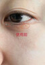 日本脂肪粒去除神器眼部專(zhuān)用去脂肪粒眼霜去脂肪粒藥膏汗管瘤克星 【單盒裝 無(wú)買(mǎi)贈】 曬單實(shí)拍圖