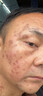 臉上黑色素沉淀去除臉部排毒排黑色素去黑斑點(diǎn)去黑色素臉部醫用皮膚色素暗沉痘印曬斑淡斑美白熊果苷軟膏 買(mǎi)二送一【免費試用】3盒 曬單實(shí)拍圖
