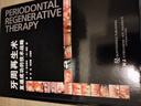 牙周再生術(shù)(直通成功的技術(shù)戰略)(精) 曬單實(shí)拍圖