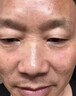 胎記去除膏神器去胎記臉部黑色素太田咖啡斑紅胎記遺傳胎記淡化老年黃褐雀斑修復祛除天生胎記膏 單盒體驗裝 曬單實(shí)拍圖