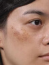 千紹方祛斑霜去斑黃褐斑雀斑曬斑女士用的強力祛除老年斑的藥手臉部美白 特效*1盒裝 進(jìn)口原裝醫用正品老年斑專(zhuān)用一夜消淡化黑色素男士 曬單實(shí)拍圖