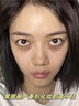 Fyatto韓國眼膜眼袋貼提拉緊致抗皺淡化細紋黑眼圈去除神器男女士嚴重 曬單實(shí)拍圖