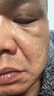 白云山眼部抗皺植萃精華油緊致淡化細紋眼袋黑眼圈補水保濕兩瓶裝40ml 曬單實(shí)拍圖