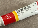 馬應龍尿素乳膏10%10g/盒 尿素軟膏尿素霜醫用尿素乳膏手腳干裂干燥手足皸裂腳后跟干裂膏角化型腳氣 曬單實(shí)拍圖