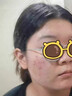 修正祛痘印修復淡化痘印醫用男士女黑色素沉淀藥膏青少年消除痘坑專(zhuān)用 【體驗裝】1盒 祛痘疤痕專(zhuān)用修復凝膠膠原蛋白 曬單實(shí)拍圖