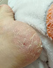 南同博士腳后跟干裂起硬皮足跟防開(kāi)裂口修復霜手足皸裂干燥脫皮手腳防裂膏 1盒裝【體驗裝】 曬單實(shí)拍圖