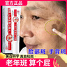 傾齡祛斑祛黑色素老年斑滋潤斑點(diǎn)臉部強力去除專(zhuān)用手背祛斑霜新年禮物 曬單實(shí)拍圖