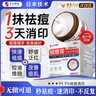 本安制藥蘆薈膠醫用級祛痘痘印淡化疤痕修復皮膚消炎抑菌保濕補水淡斑曬傷 曬單實(shí)拍圖